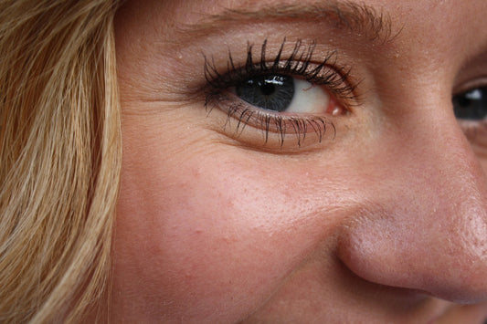 Wrinkles: Causes, Effects, and Natural Solutions for Youthful Skin