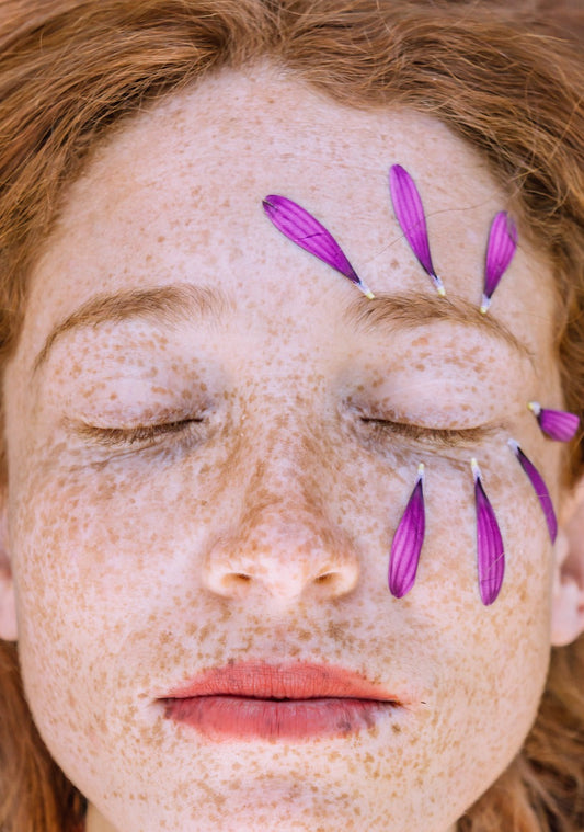 Uneven Skin Tone: Causes, Effects, and Natural Solutions
